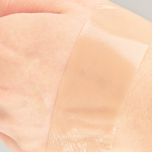What Makes Silicone Gel Sheets a Preferred Choice for Scar Management?
